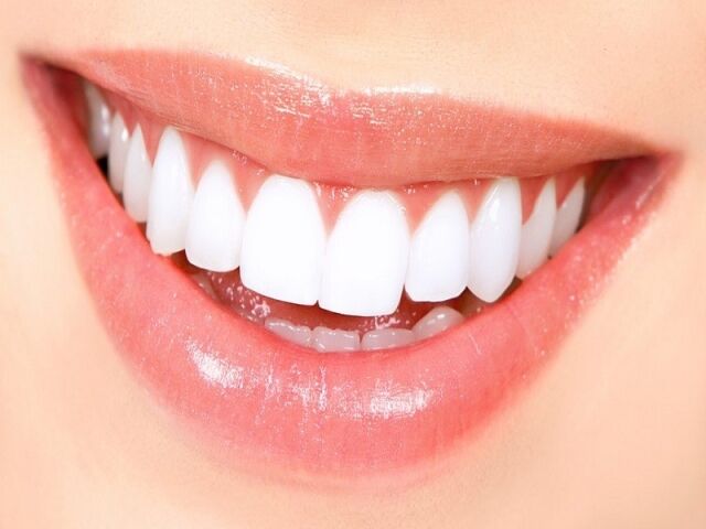 teeth whitening burbank