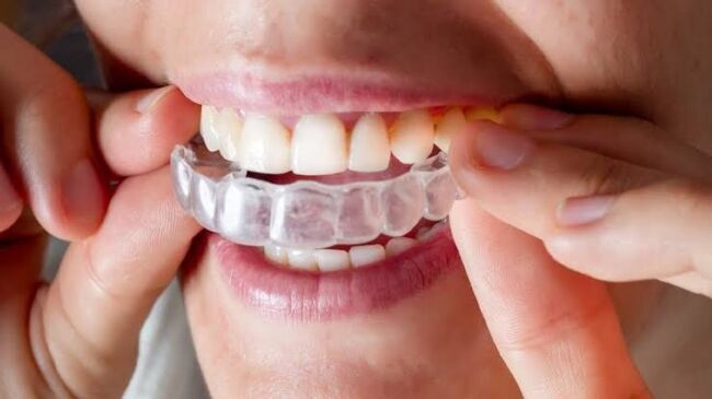 Orthodontic Treatment Burbank